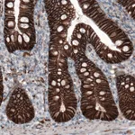 Atlas Antibodies Anti-CTNNB1 Antibody