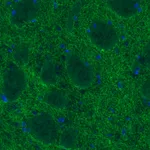 Atlas Antibodies Anti-DAT Antibody