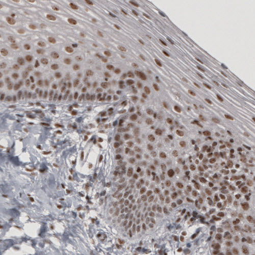 Atlas Antibodies Anti-DAXX Antibody