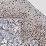 Atlas Antibodies Anti-DAXX Antibody