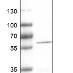 Atlas Antibodies Anti-DES Antibody