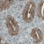 Atlas Antibodies Anti-DIAPH2 Antibody