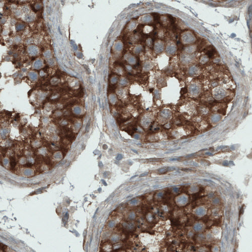 Atlas Antibodies Anti-DIAPH2 Antibody