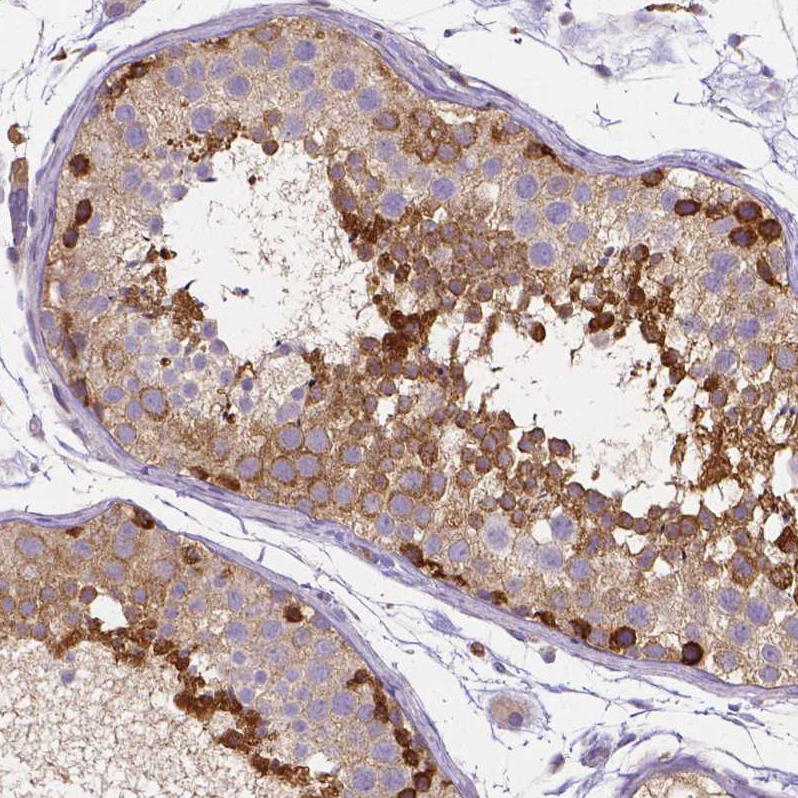 Atlas Antibodies Anti-DICER1 Antibody