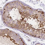 Atlas Antibodies Anti-DICER1 Antibody