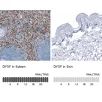 Atlas Antibodies Anti-DYSF Antibody
