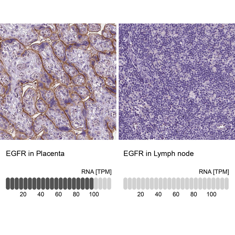 Atlas Antibodies Anti-EGFR Antibody