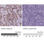 Atlas Antibodies Anti-EGFR Antibody