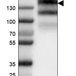 Atlas Antibodies Anti-EGFR Antibody