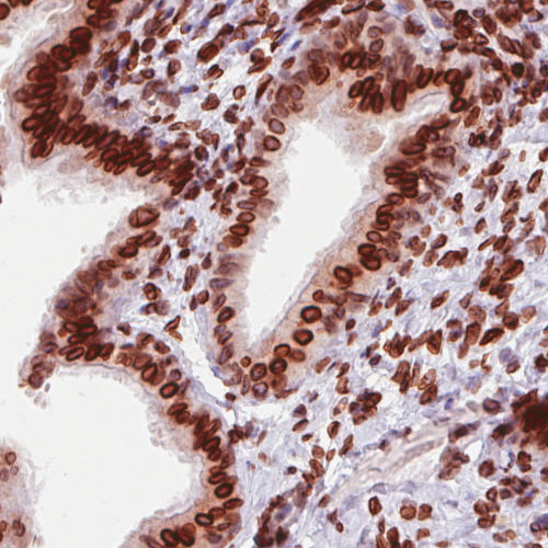 Atlas Antibodies Anti-EMD Antibody