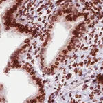 Atlas Antibodies Anti-EMD Antibody