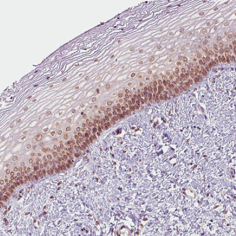 Atlas Antibodies Anti-EMD Antibody