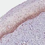 Atlas Antibodies Anti-EMD Antibody