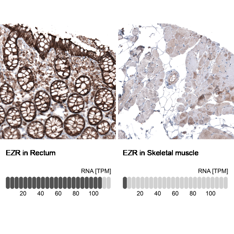 Atlas Antibodies Anti-EZR Antibody
