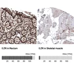 Atlas Antibodies Anti-EZR Antibody