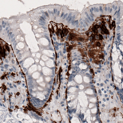 Atlas Antibodies Anti-F3 Antibody