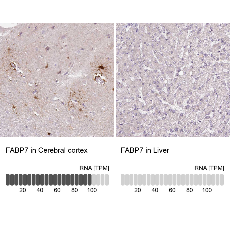 Atlas Antibodies Anti-FABP7 Antibody