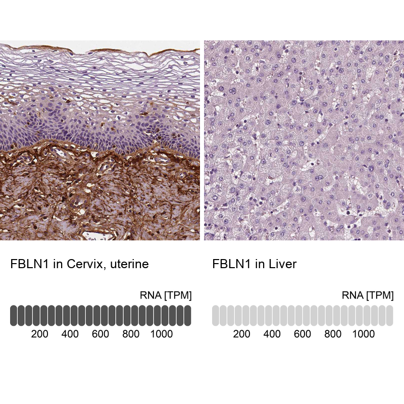 Atlas Antibodies Anti-FBLN1 Antibody