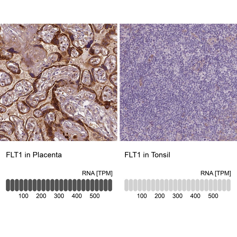 Atlas Antibodies Anti-FLT1 Antibody