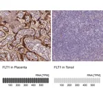 Atlas Antibodies Anti-FLT1 Antibody