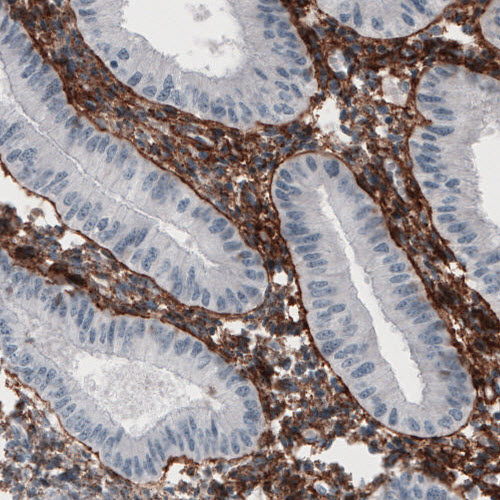 Atlas Antibodies Anti-FN1 Antibody