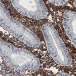 Atlas Antibodies Anti-FN1 Antibody