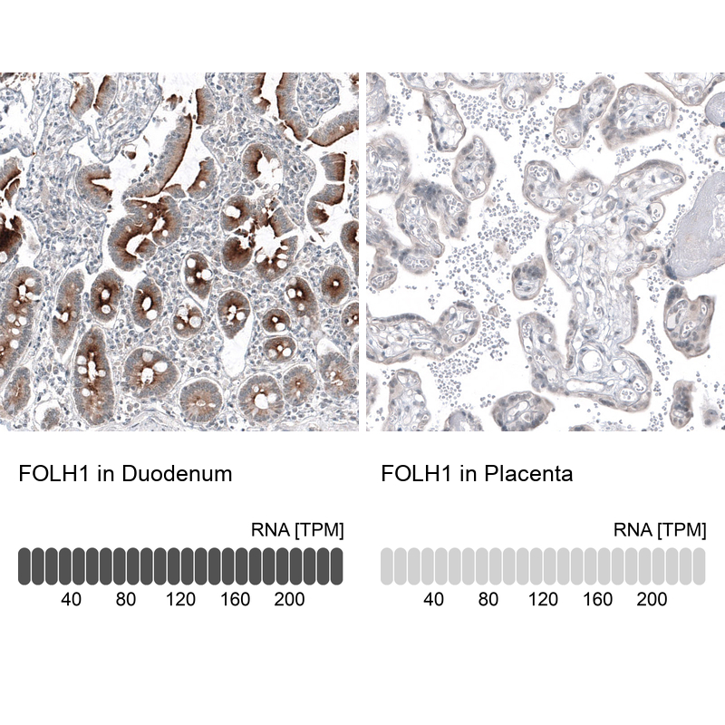 Atlas Antibodies Anti-FOLH1 Antibody