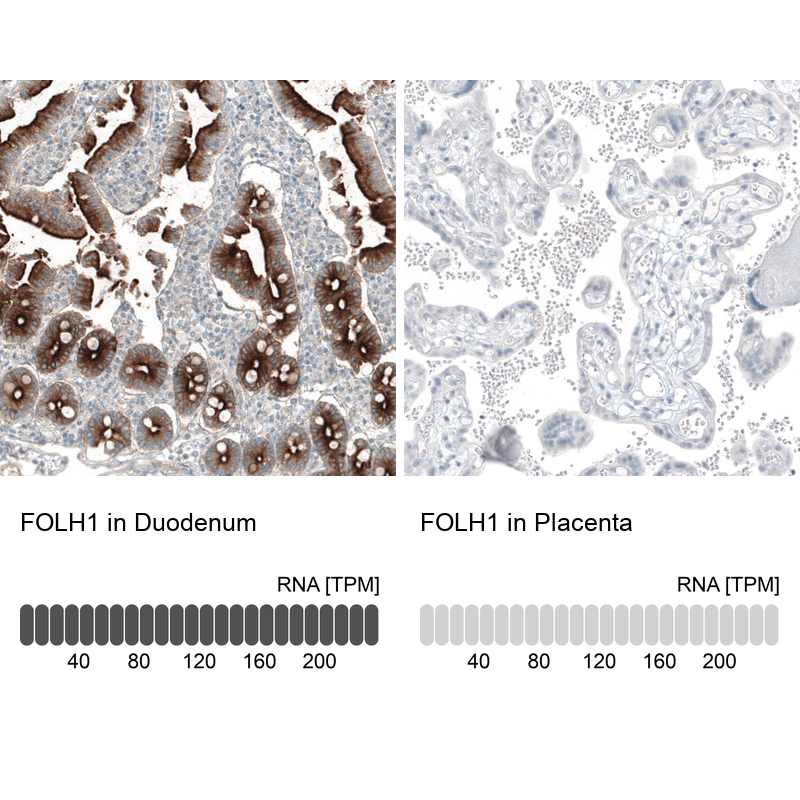 Atlas Antibodies Anti-FOLH1 Antibody