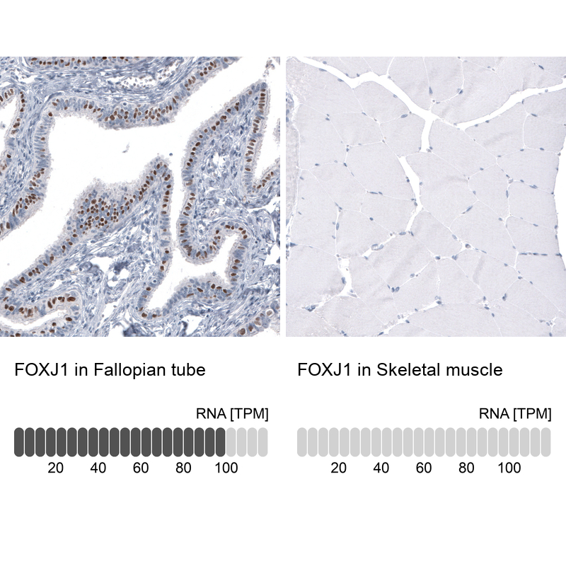 Atlas Antibodies Anti-FOXJ1 Antibody