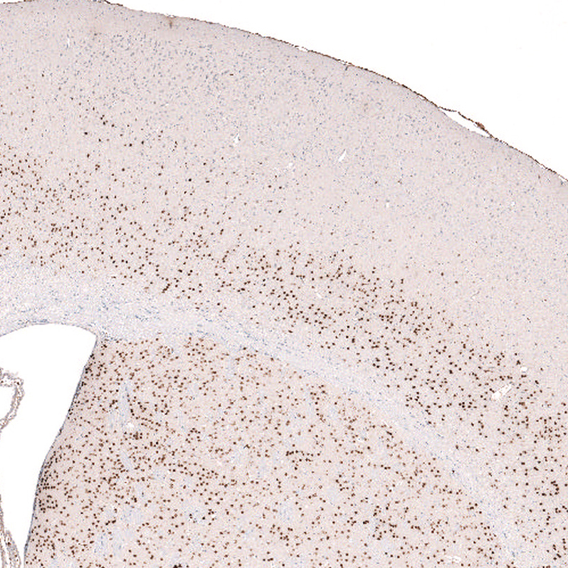 Atlas Antibodies Anti-FOXP2 Antibody