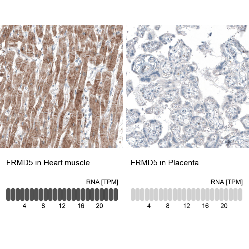Atlas Antibodies Anti-FRMD5 Antibody