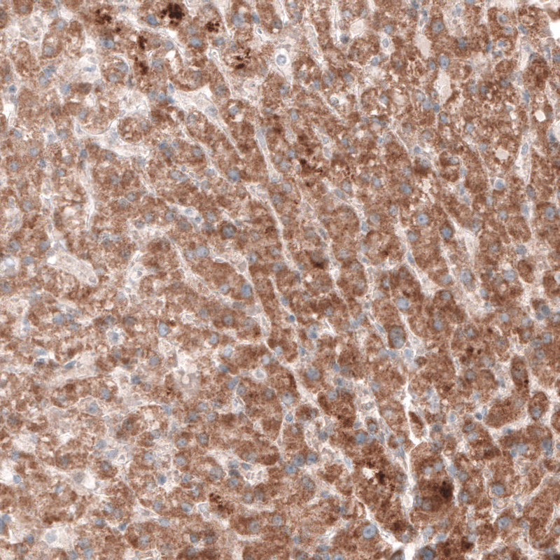 Atlas Antibodies Anti-G6PC Antibody