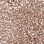 Atlas Antibodies Anti-G6PC Antibody