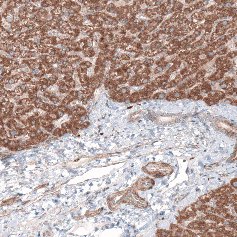 Atlas Antibodies Anti-G6PC Antibody
