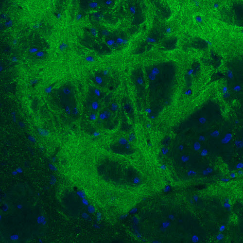 Atlas Antibodies Anti-GAD1 Antibody