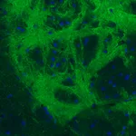 Atlas Antibodies Anti-GAD1 Antibody