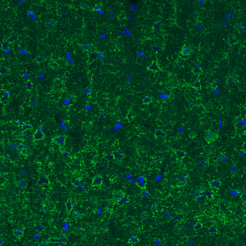 Atlas Antibodies Anti-GAD1 Antibody