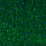 Atlas Antibodies Anti-GAD1 Antibody