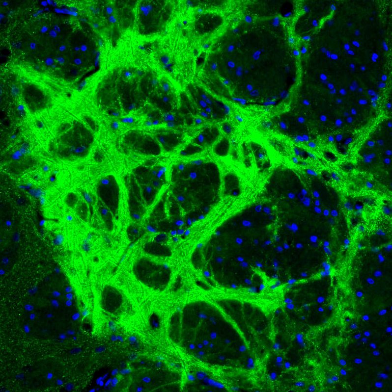 Atlas Antibodies Anti-GAD1 Antibody
