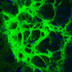 Atlas Antibodies Anti-GAD1 Antibody