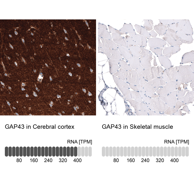 Atlas Antibodies Anti-GAP43 Antibody