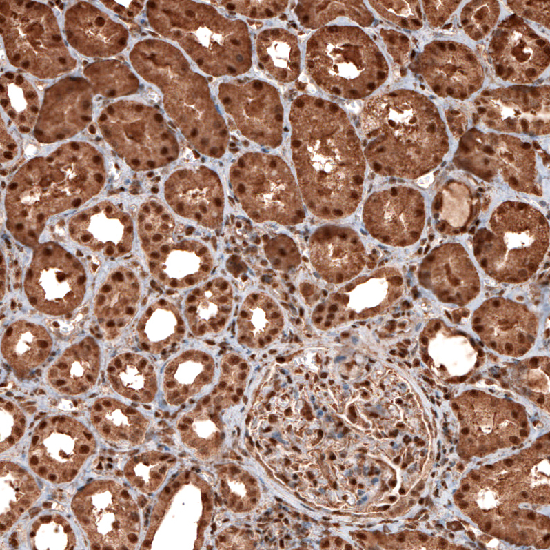 Atlas Antibodies Anti-GAPDH Antibody
