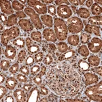 Atlas Antibodies Anti-GAPDH Antibody