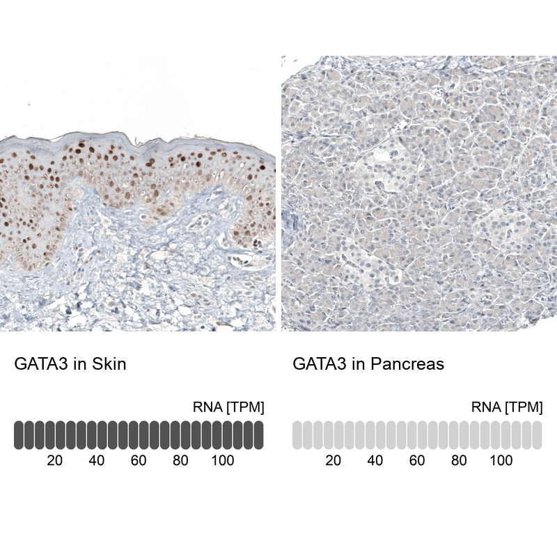 Atlas Antibodies Anti-GATA3 Antibody