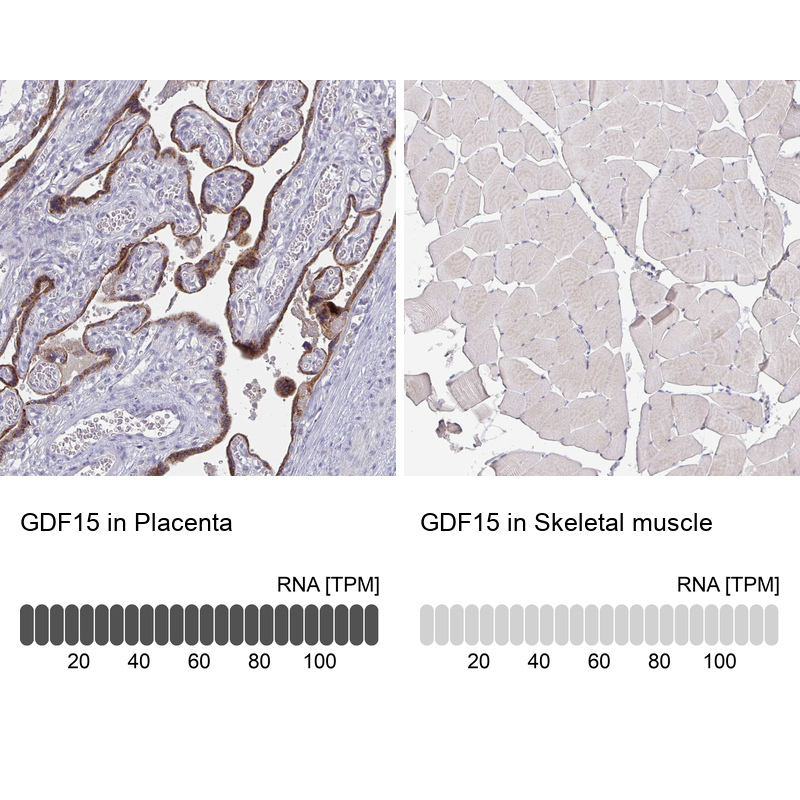 Atlas Antibodies Anti-GDF15 Antibody