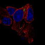 Atlas Antibodies Anti-GJB6 Antibody