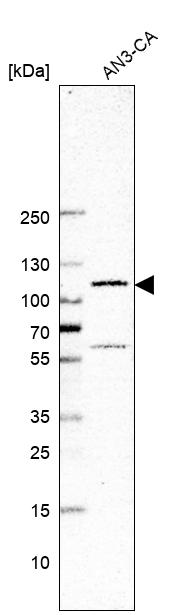 Atlas Antibodies Anti-GLI1 Antibody