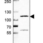 Atlas Antibodies Anti-GLI1 Antibody