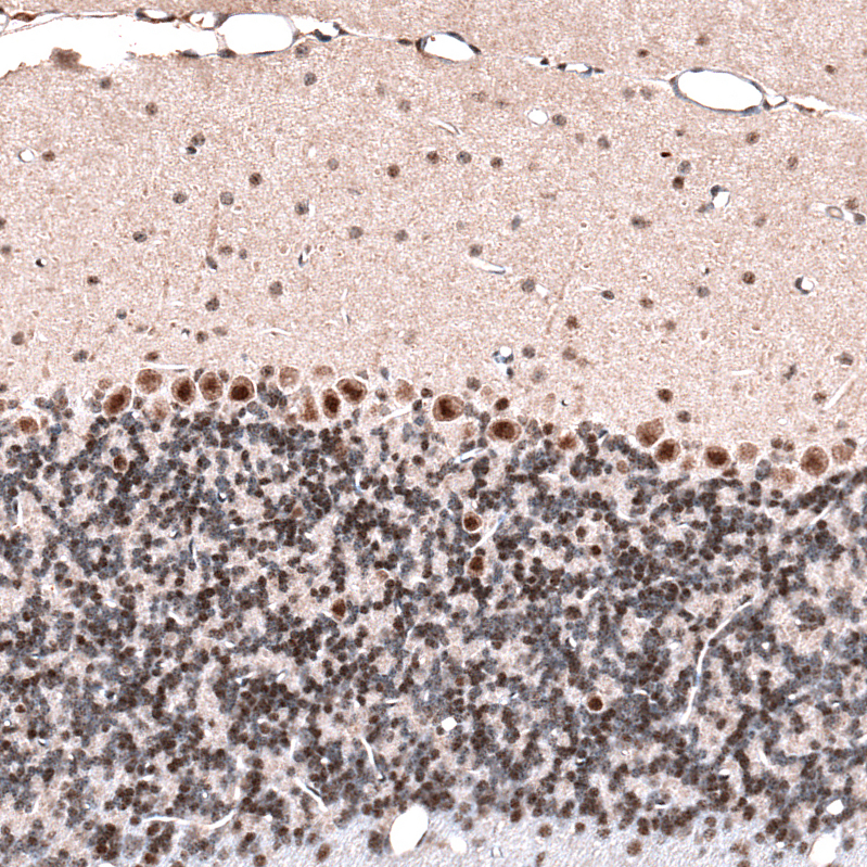 Atlas Antibodies Anti-GLI1 Antibody