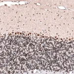 Atlas Antibodies Anti-GLI1 Antibody
